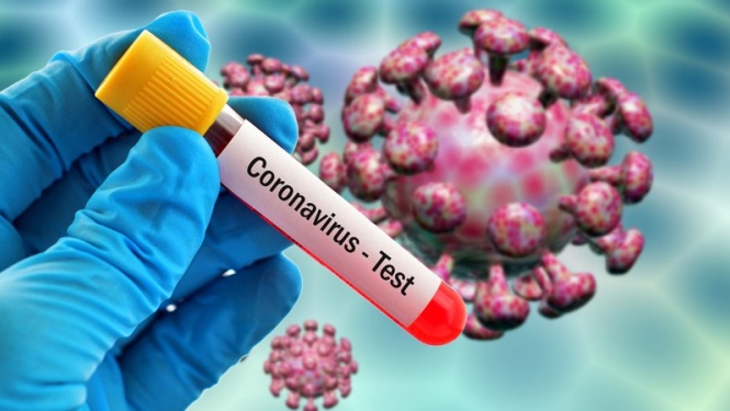 Koronavirus tests