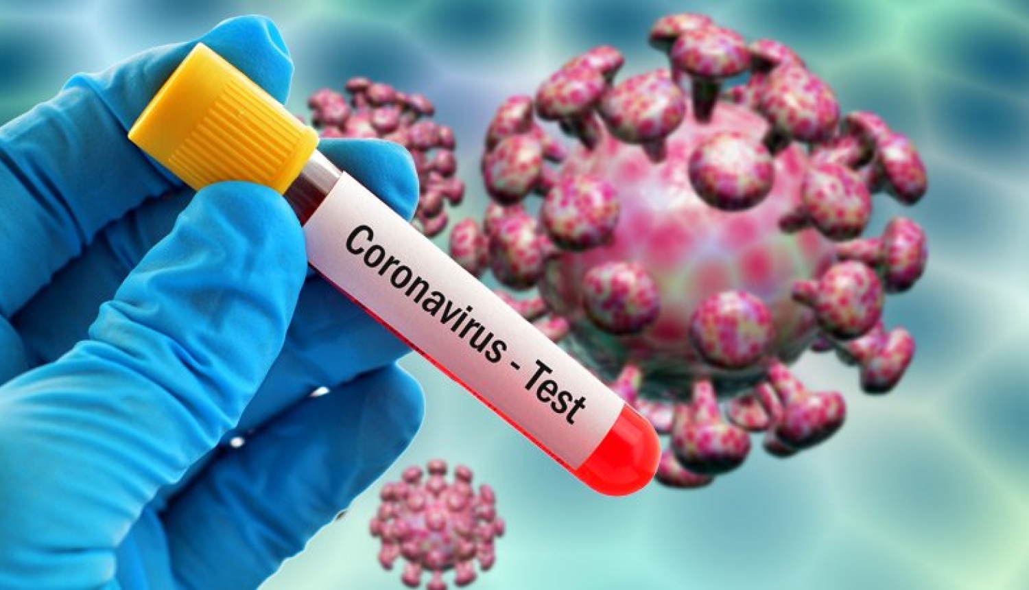 Koronavirus tests